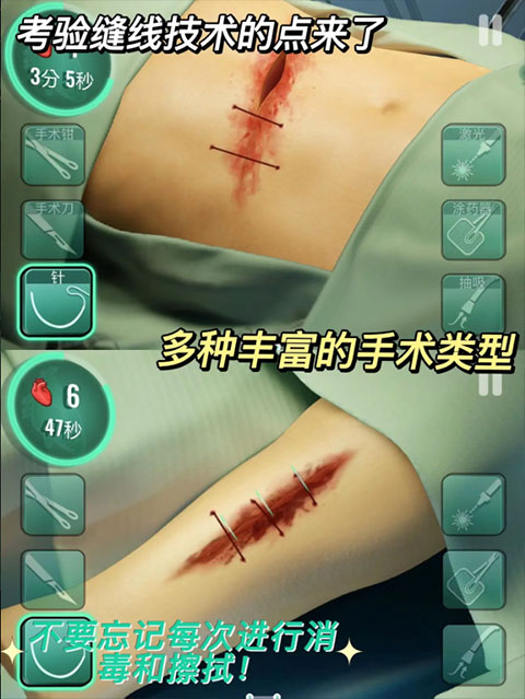 医院手术时间安卓中文版